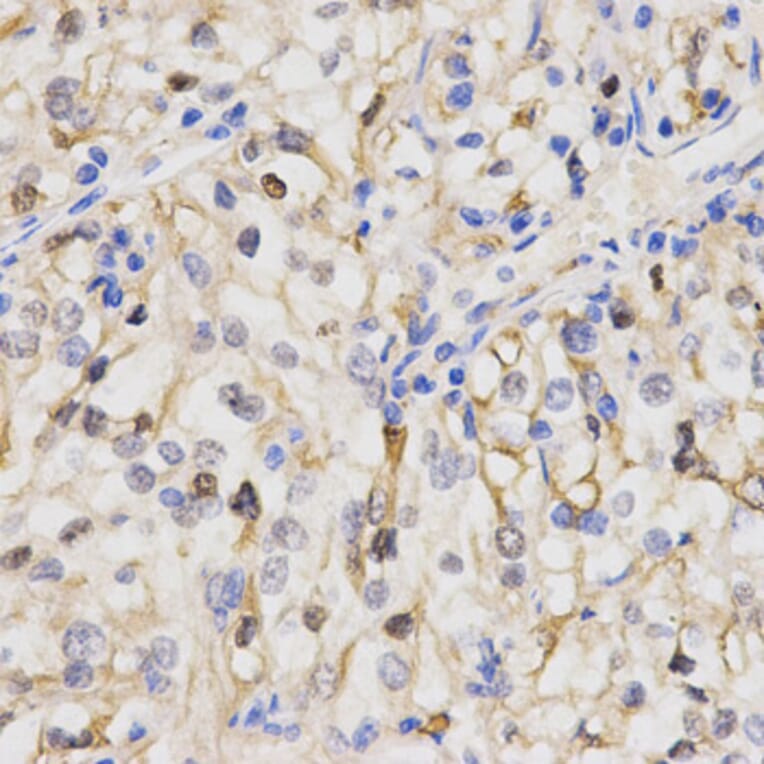 Anti-PPP2R4 Antibody from Bioworld Technology (BS7316) - Antibodies.com