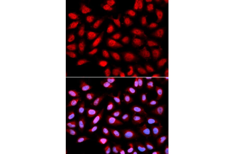 Anti-PPP2R4 Antibody from Bioworld Technology (BS7316) - Antibodies.com
