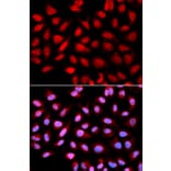Anti-PPP2R4 Antibody from Bioworld Technology (BS7316) - Antibodies.com