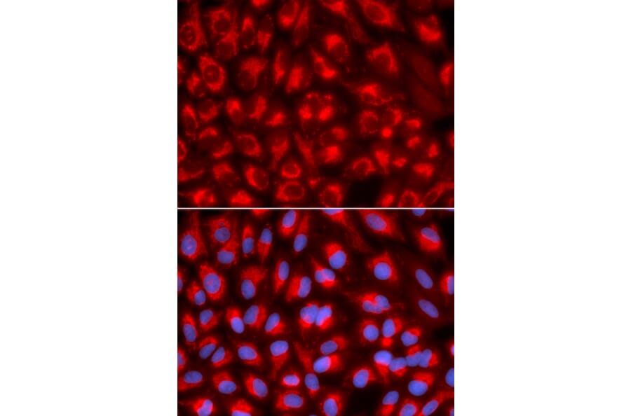 Anti-TFAM Antibody from Bioworld Technology (BS7319) - Antibodies.com