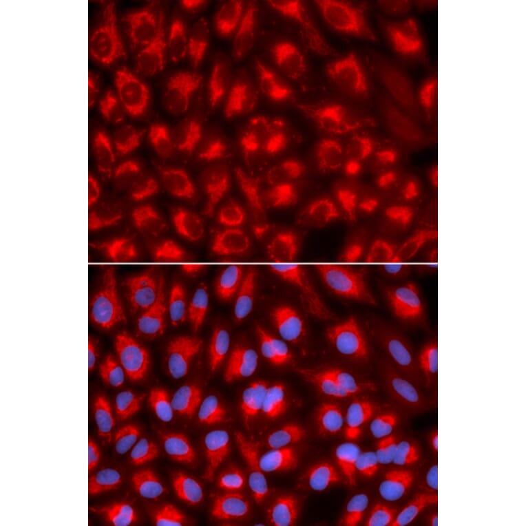 Anti-TFAM Antibody from Bioworld Technology (BS7319) - Antibodies.com