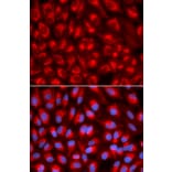 Anti-TFAM Antibody from Bioworld Technology (BS7319) - Antibodies.com