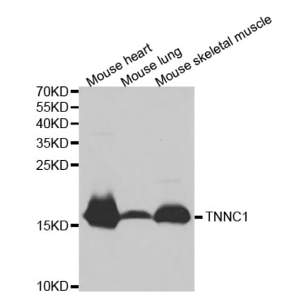 Anti-TNNC1 Antibody from Bioworld Technology (BS7320) - Antibodies.com