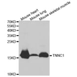 Anti-TNNC1 Antibody from Bioworld Technology (BS7320) - Antibodies.com