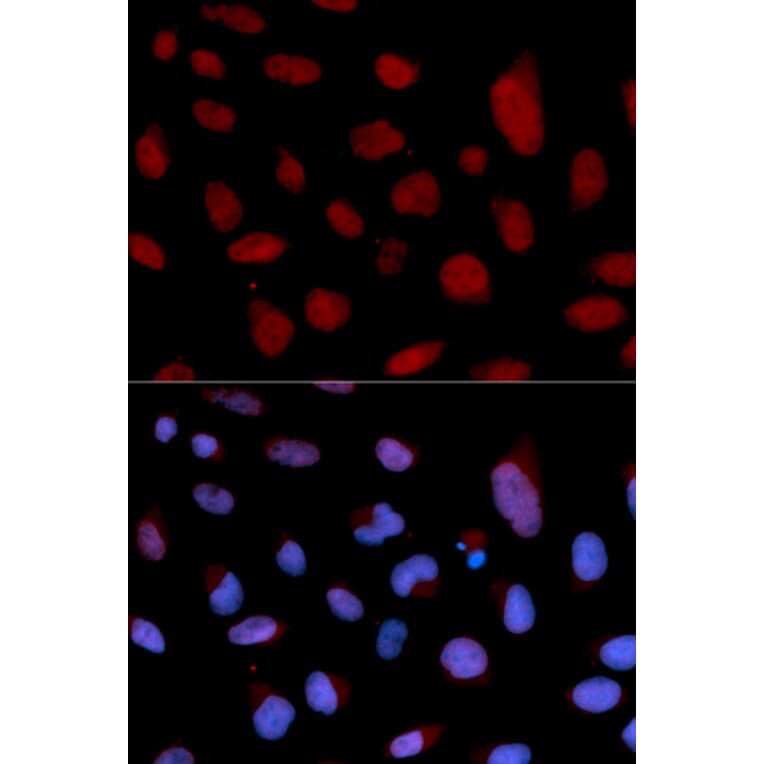 Anti-TNNC1 Antibody from Bioworld Technology (BS7320) - Antibodies.com