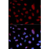 Anti-TNNC1 Antibody from Bioworld Technology (BS7320) - Antibodies.com