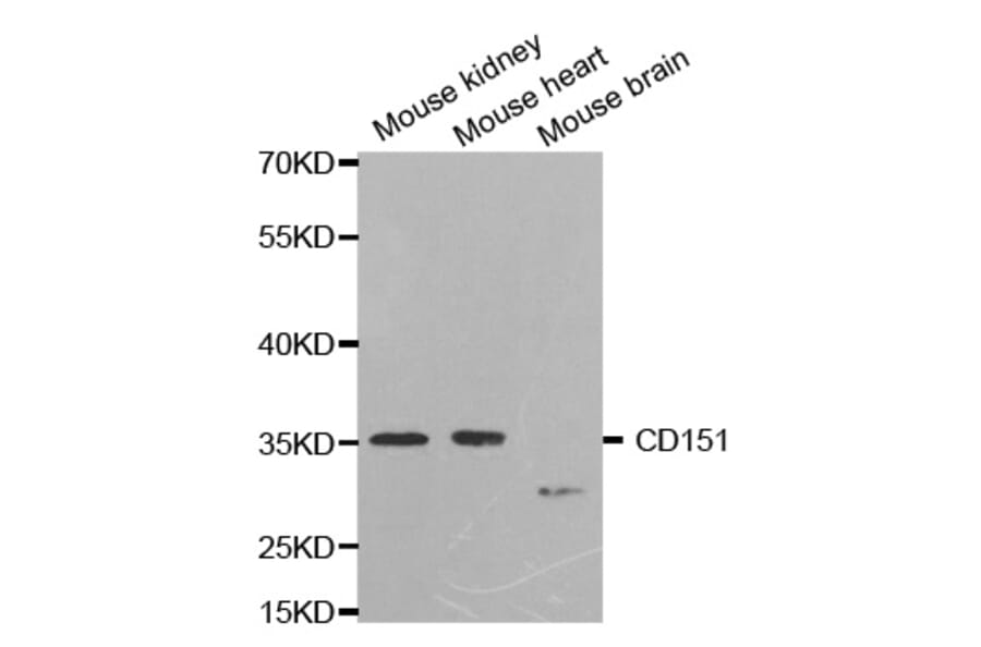 Anti-CD151 Antibody from Bioworld Technology (BS7321) - Antibodies.com