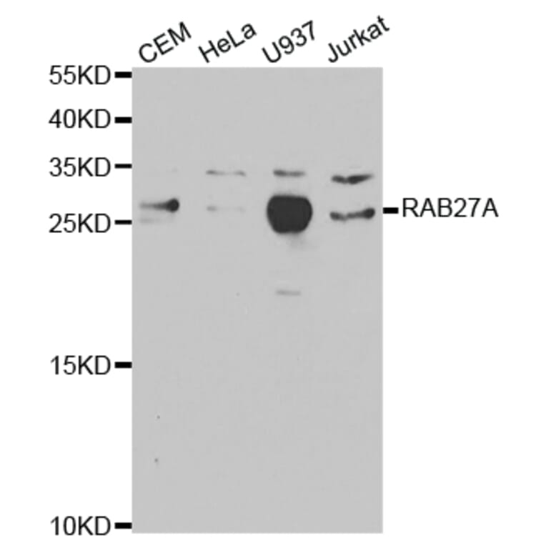 Anti-RAB27A Antibody from Bioworld Technology (BS7324) - Antibodies.com