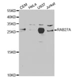 Anti-RAB27A Antibody from Bioworld Technology (BS7324) - Antibodies.com
