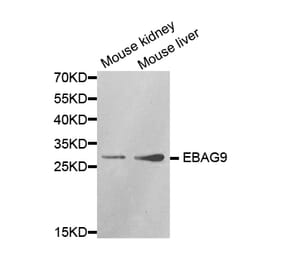 Anti-EBAG9 Antibody from Bioworld Technology (BS7325) - Antibodies.com