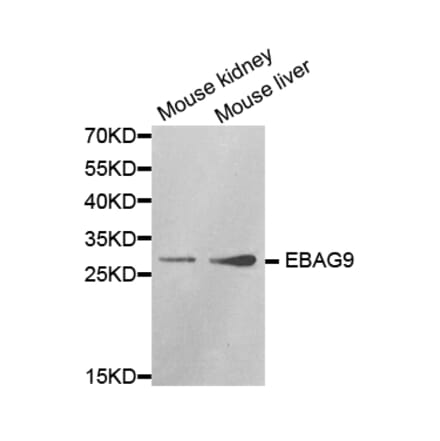 Anti-EBAG9 Antibody from Bioworld Technology (BS7325) - Antibodies.com