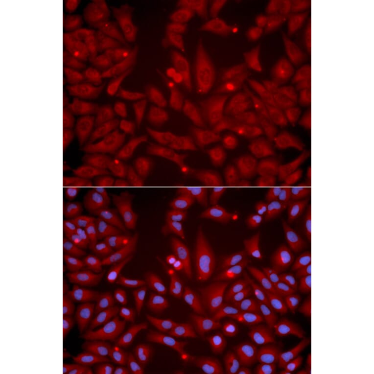 Anti-GRIK2 Antibody from Bioworld Technology (BS7327) - Antibodies.com