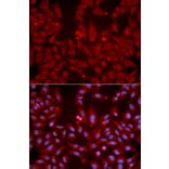Anti-GRIK2 Antibody from Bioworld Technology (BS7327) - Antibodies.com