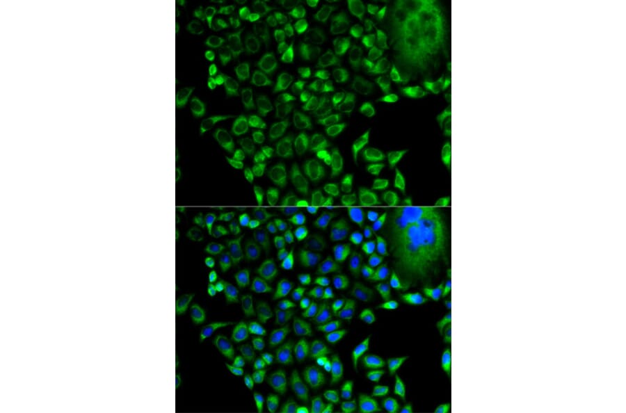 Anti-PSMD10 Antibody from Bioworld Technology (BS7330) - Antibodies.com