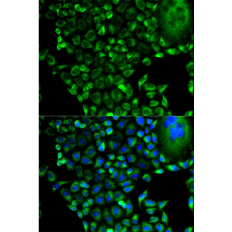 Anti-PSMD10 Antibody from Bioworld Technology (BS7330) - Antibodies.com