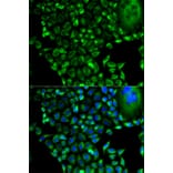 Anti-PSMD10 Antibody from Bioworld Technology (BS7330) - Antibodies.com