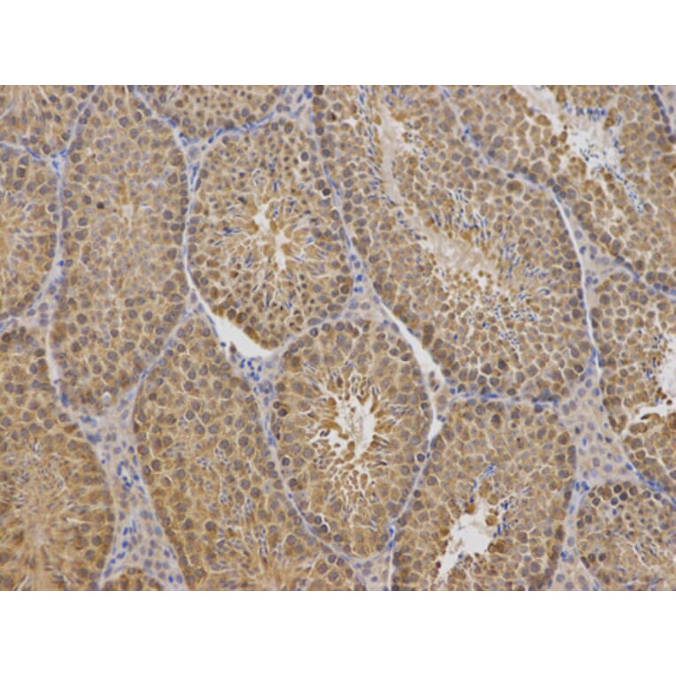 Anti-TCP1 Antibody from Bioworld Technology (BS7331) - Antibodies.com