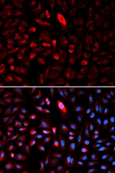 Anti-TCP1 Antibody (A30532) | Antibodies.com