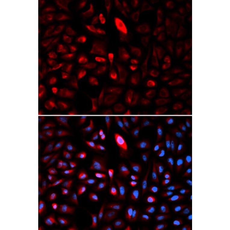Anti-TCP1 Antibody from Bioworld Technology (BS7331) - Antibodies.com