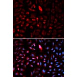 Anti-TCP1 Antibody from Bioworld Technology (BS7331) - Antibodies.com