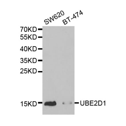 Anti-UBE2D1 Antibody from Bioworld Technology (BS7332) - Antibodies.com