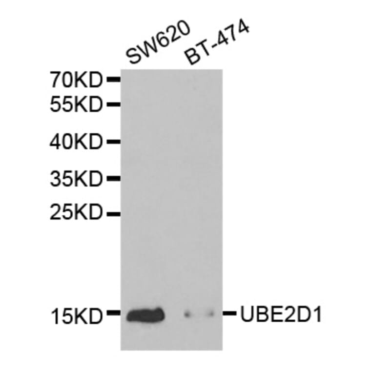 Anti-UBE2D1 Antibody from Bioworld Technology (BS7332) - Antibodies.com