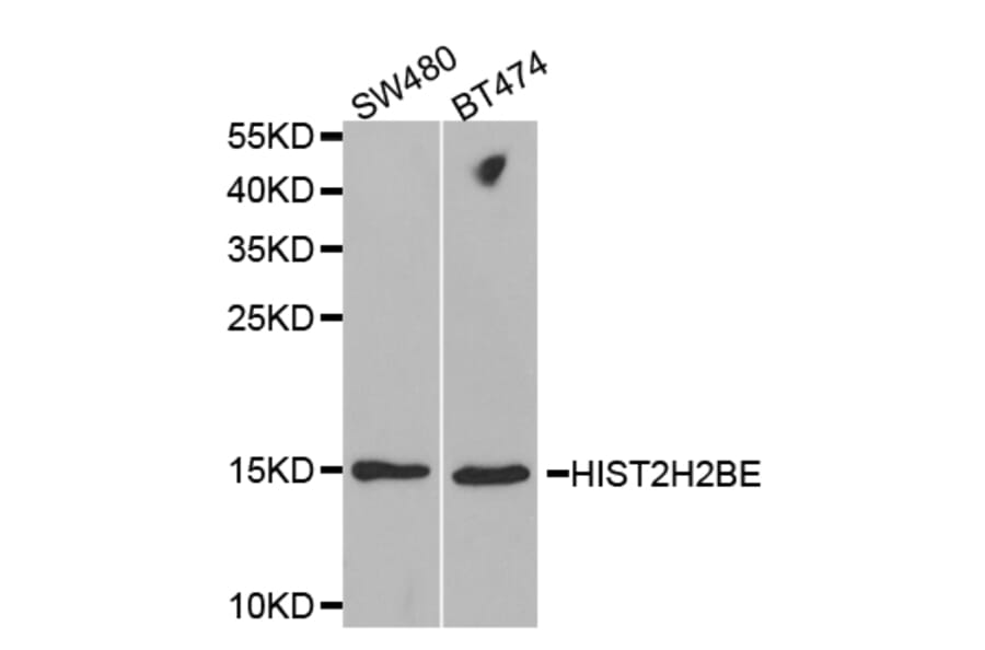 Anti-HIST2H2BE Antibody from Bioworld Technology (BS7334) - Antibodies.com