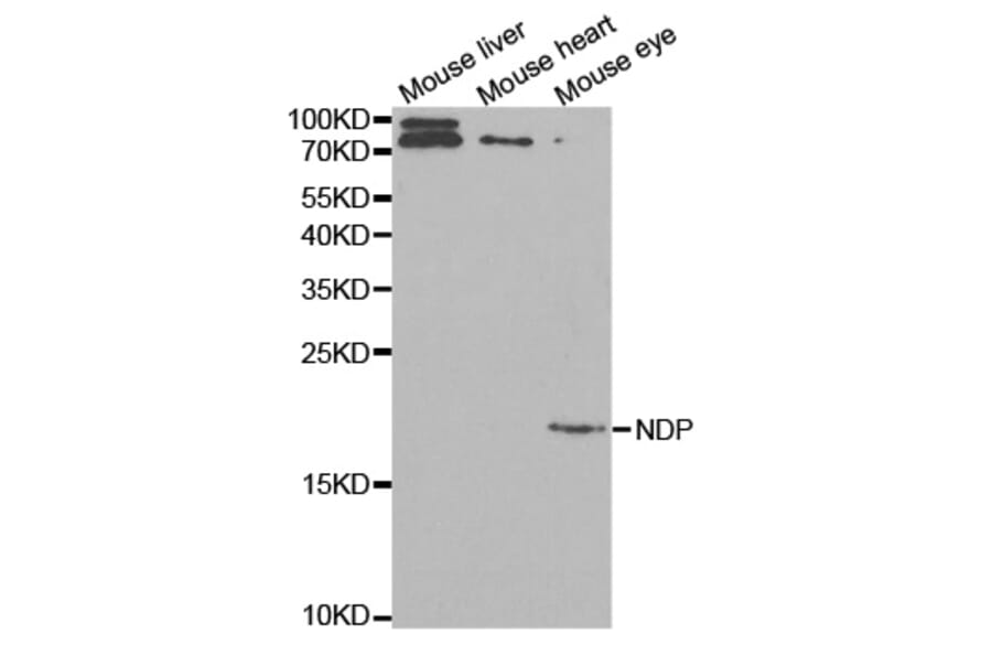 Anti-NDP Antibody from Bioworld Technology (BS7336) - Antibodies.com