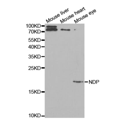 Anti-NDP Antibody from Bioworld Technology (BS7336) - Antibodies.com