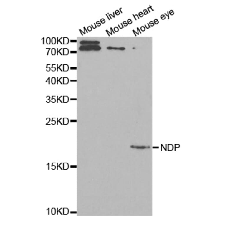 Anti-NDP Antibody from Bioworld Technology (BS7336) - Antibodies.com