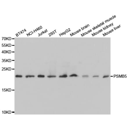 Anti-PSMB5 Antibody from Bioworld Technology (BS7338) - Antibodies.com