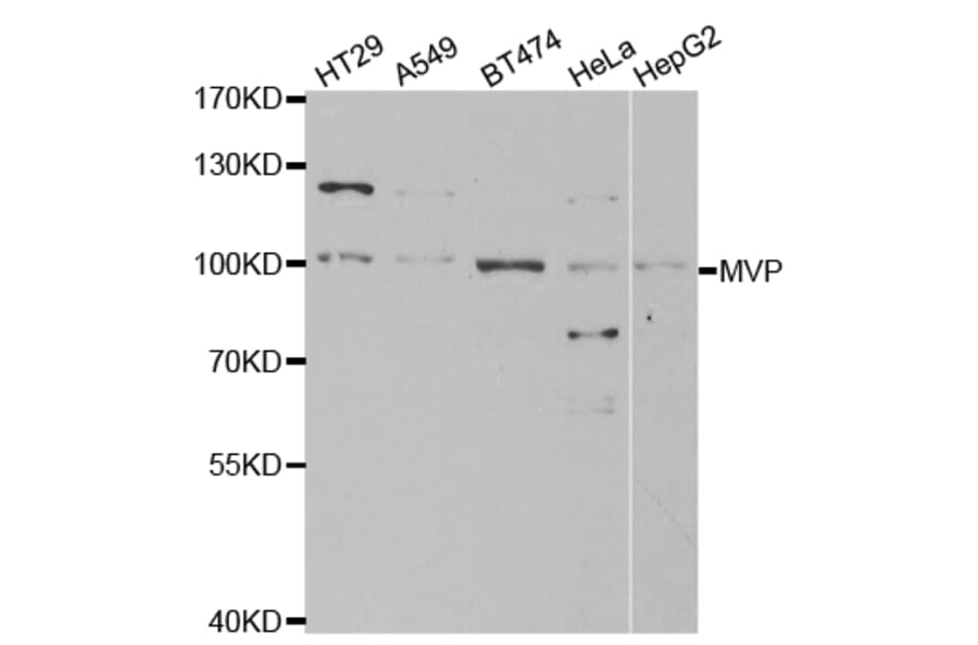 Anti-MVP Antibody from Bioworld Technology (BS7339) - Antibodies.com