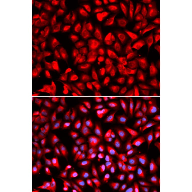 Anti-IPO5 Antibody from Bioworld Technology (BS7341) - Antibodies.com