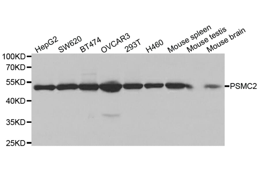 Anti-PSMC2 Antibody from Bioworld Technology (BS7342) - Antibodies.com