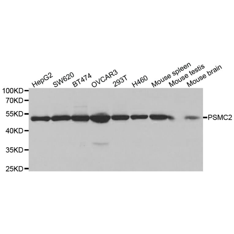 Anti-PSMC2 Antibody from Bioworld Technology (BS7342) - Antibodies.com