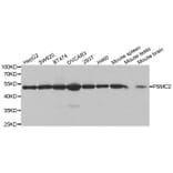 Anti-PSMC2 Antibody from Bioworld Technology (BS7342) - Antibodies.com