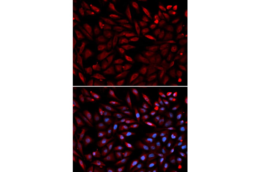 Anti-PSMC2 Antibody from Bioworld Technology (BS7342) - Antibodies.com