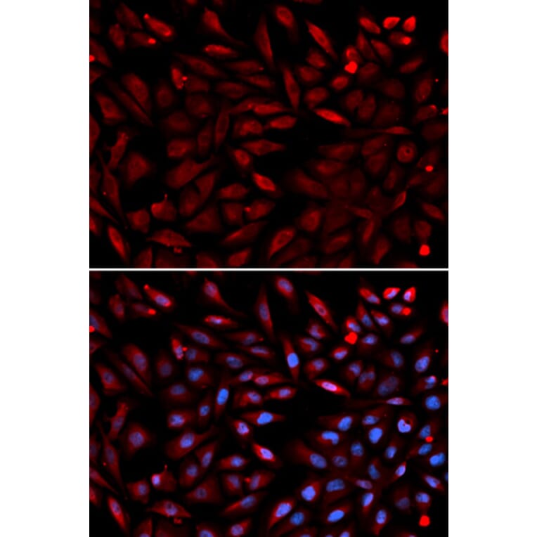 Anti-PSMC2 Antibody from Bioworld Technology (BS7342) - Antibodies.com