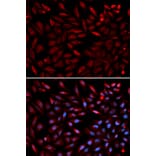 Anti-PSMC2 Antibody from Bioworld Technology (BS7342) - Antibodies.com
