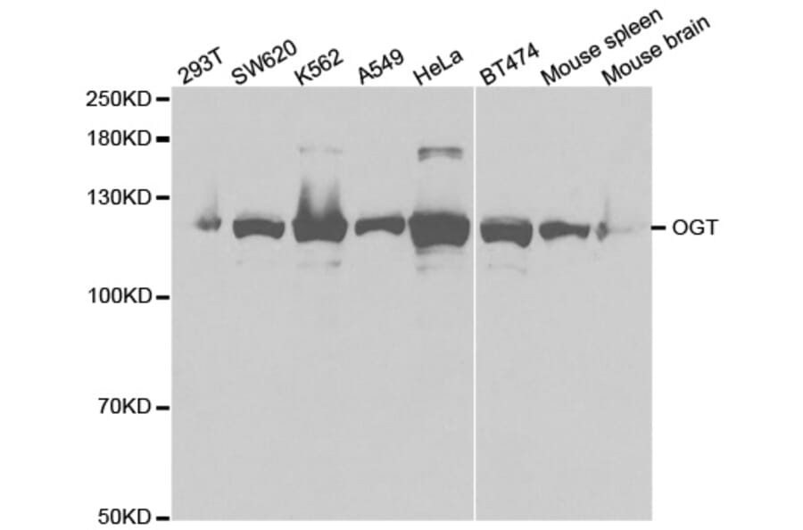 Anti-OGT Antibody from Bioworld Technology (BS7343) - Antibodies.com