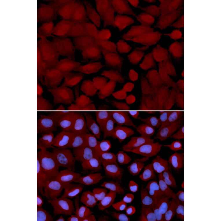Anti-OGT Antibody from Bioworld Technology (BS7343) - Antibodies.com