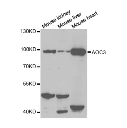 Anti-AOC3 Antibody from Bioworld Technology (BS7346) - Antibodies.com