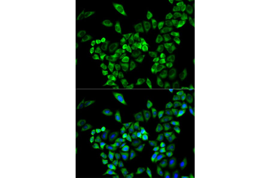 Anti-AOC3 Antibody from Bioworld Technology (BS7346) - Antibodies.com