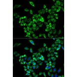 Anti-AOC3 Antibody from Bioworld Technology (BS7346) - Antibodies.com