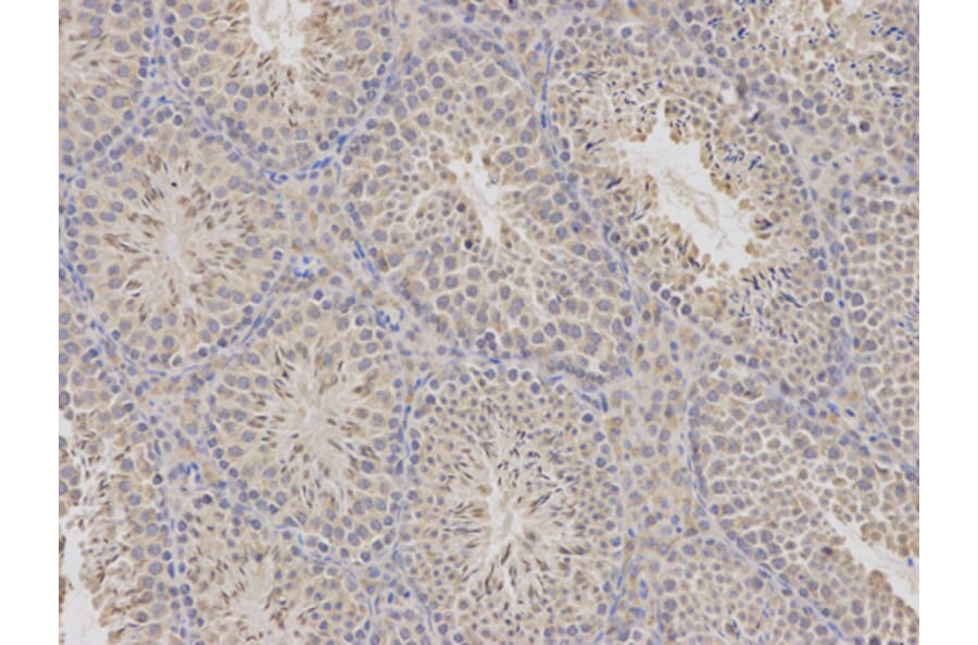 Anti-CDA Antibody from Bioworld Technology (BS7348) - Antibodies.com