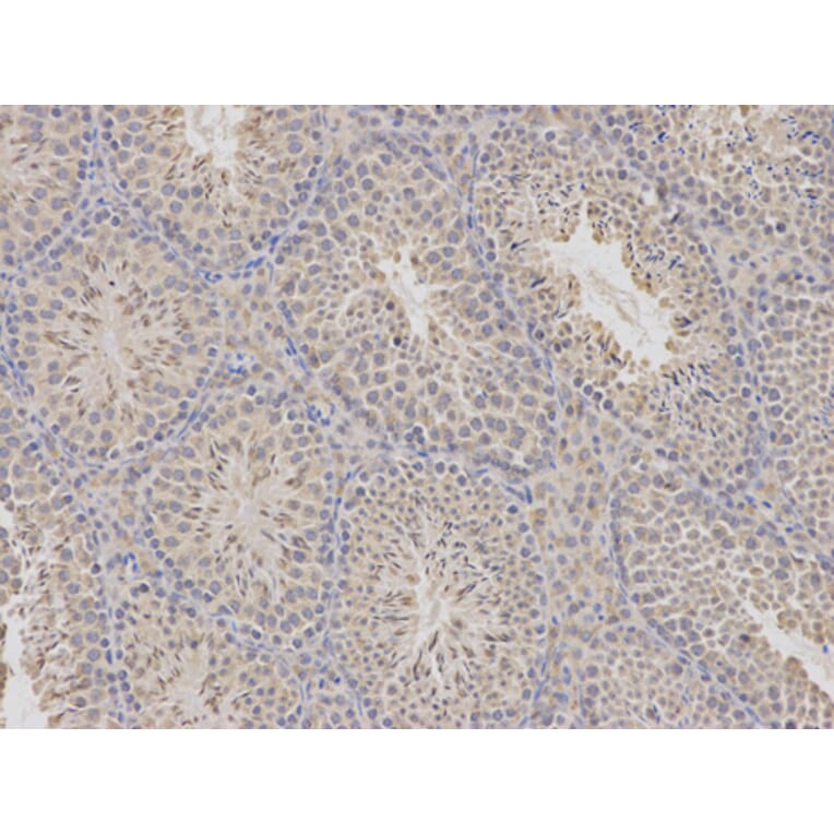 Anti-CDA Antibody from Bioworld Technology (BS7348) - Antibodies.com