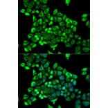 Anti-CDA Antibody from Bioworld Technology (BS7348) - Antibodies.com