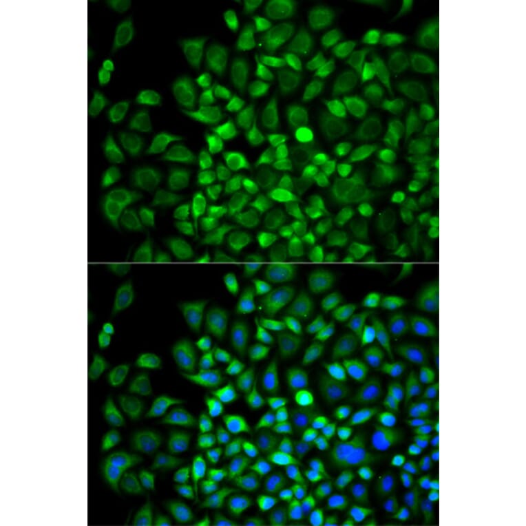 Anti-ANGPTL4 Antibody from Bioworld Technology (BS7349) - Antibodies.com