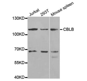 Anti-CBLB Antibody from Bioworld Technology (BS7350) - Antibodies.com