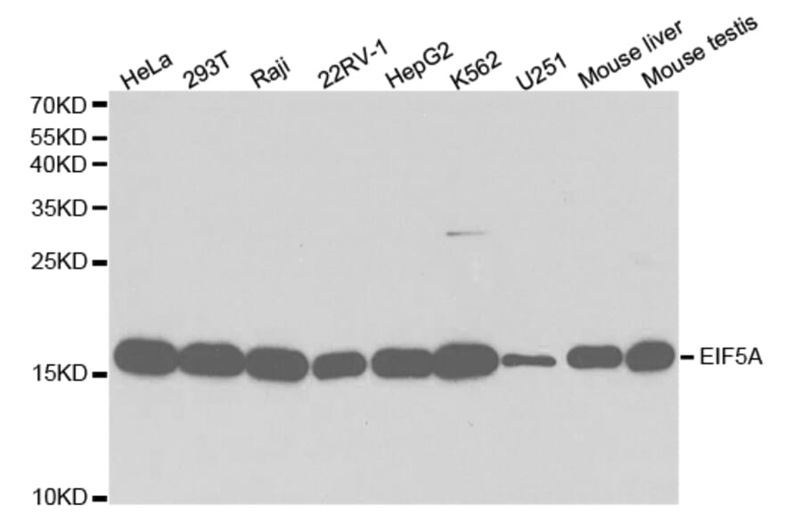 Anti-EIF5A Antibody from Bioworld Technology (BS7351) - Antibodies.com